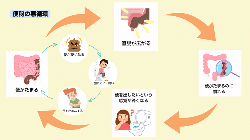 便秘の悪循環図